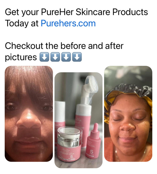 PureHer